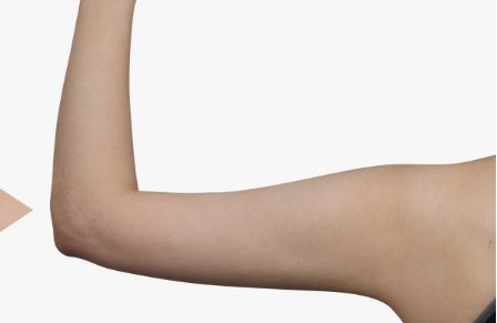 銀川陳勇博士醫(yī)療美容整形醫(yī)院醫(yī)生團(tuán)隊(duì)是否備受認(rèn)可？他們的案例能夠展現(xiàn)多少成功經(jīng)驗(yàn)？