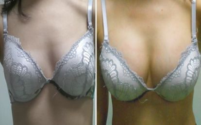 宜昌瑞銘整形醫(yī)院鼻子整形效果如何？有專家推崇！