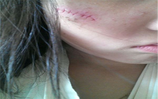 鄭州整形醫(yī)院排行前五！這五家醫(yī)院值得一看！