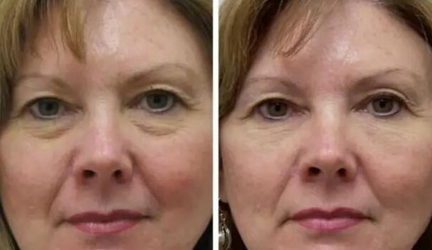 廣州植發(fā)領(lǐng)先機(jī)構(gòu)推薦：連鎖醫(yī)院專業(yè)信譽備受肯定！