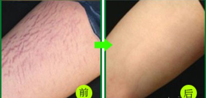 杭州整容醫(yī)院推薦，這幾家非常值得選擇