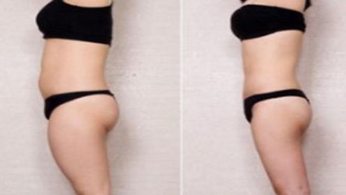 上海有哪些值得推薦的眼部修復(fù)醫(yī)院？前五脫穎而出，口碑極佳，讓你放心選擇