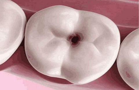 滄州有哪些醫(yī)院可以信賴進行開眼角手術(shù)？如何選擇更適合自己的醫(yī)院？