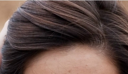 華西美容整形科在哪里？想問問有沒有人去過這里的整形醫(yī)院？