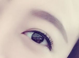 劉春軍豐胸手術(shù)后效果如何？費(fèi)用怎么樣？醫(yī)生概況+隆胸真實(shí)案例圖為參考