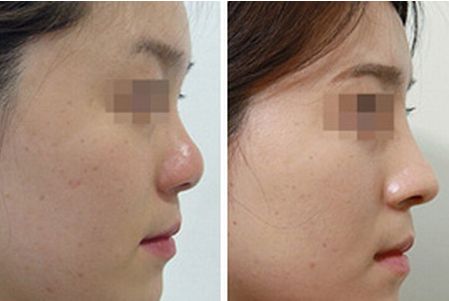 巴中市人民醫(yī)院口腔科及醫(yī)生介紹，種植牙費(fèi)用查詢