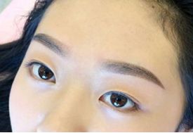 最佳選擇！濟(jì)南眼部整形資深專家Top10名單揭曉