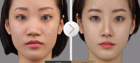 上海十大受歡迎的雙眼皮醫(yī)院排行榜