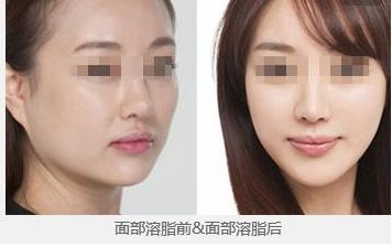 2024年昆明哪家整形醫(yī)院更受歡迎？你一定不知道！