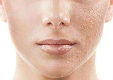 徐州三院整形美容科的蘇本玄主任值得信賴嗎？他有哪些專業(yè)優(yōu)勢(shì)？