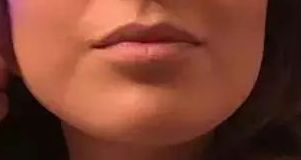 2023北京八大處醫(yī)院雙眼皮手術(shù)醫(yī)生榜單揭曉，楊明勇、王佳琦、靳小雷等醫(yī)師備受好評(píng)！