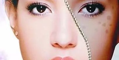 上海眼部修復(fù)專家推薦，治療眼部問(wèn)題可信賴！