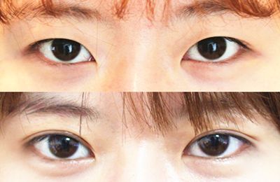 蚌埠醫(yī)學(xué)院第一附屬醫(yī)院眼科權(quán)威專家推薦！