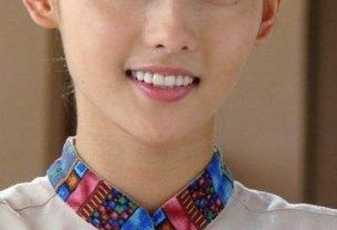 濟(jì)南芭莎美恩吳院長的醫(yī)術(shù)如何？親身雙眼皮成功案例分享！