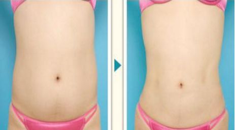 上海頂級疤痕治療醫(yī)院推薦，排名前三，性價比超高！