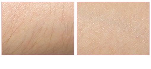 沈陽沈河盛京尚美醫(yī)療美容門診部值得信任嗎？當?shù)鼐用駥ζ淇诒绾卧u價？