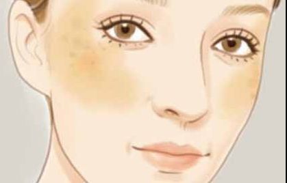 嘗試挑戰(zhàn)的你是否好奇劉珍君雙眼皮質量如何？