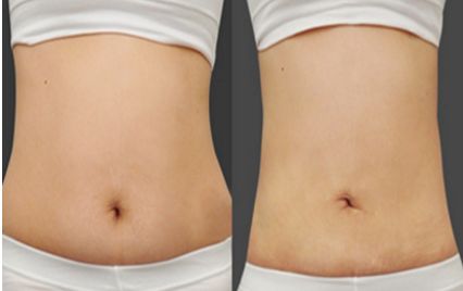 北京哪家醫(yī)院有優(yōu)質的兔唇修復醫(yī)療服務？