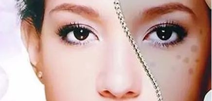 周一雄如何預約雙眼皮手術？案例分享與價格真實評估