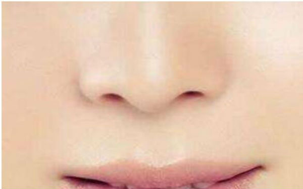 北京唇裂修復(fù)有哪些醫(yī)院可以選擇？醫(yī)術(shù)優(yōu)秀，口碑良好的醫(yī)院有哪些？