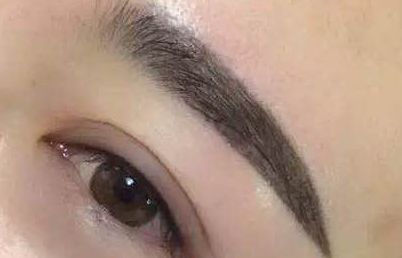 廈門鄭亞榮醫(yī)師就醫(yī)經(jīng)歷如何？患者真實案例分享及診療費用明細(xì)更新！