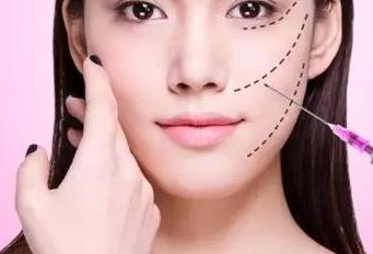 恢復(fù)青春 了解最佳雙眼皮美容科技 和成功案例