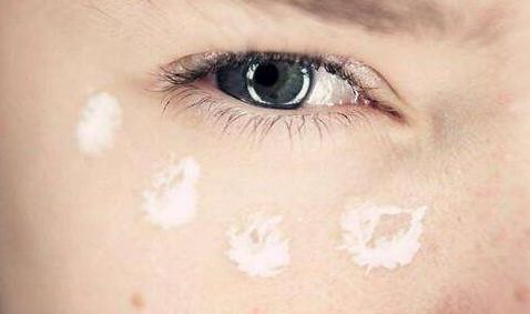 皮肉腔軟骨隆鼻手術(shù)費(fèi)用如何？鼻部整形手術(shù)安全可靠，詳細(xì)操作圖解！