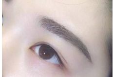 重慶銅雀臺(tái)地區(qū)雙眼皮手術(shù)頂級(jí)醫(yī)生推薦！詳細(xì)收費(fèi)一覽表