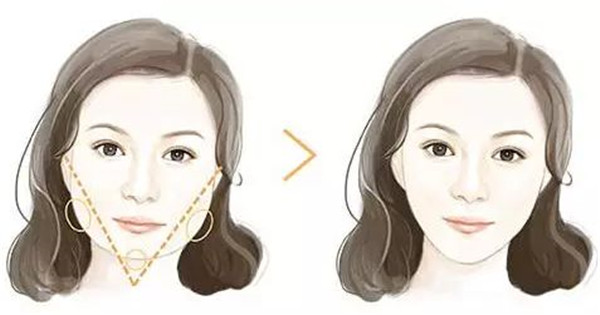 深圳吸脂修復(fù)醫(yī)院哪家專業(yè)？這八強(qiáng)機(jī)構(gòu)到底有何絕技？