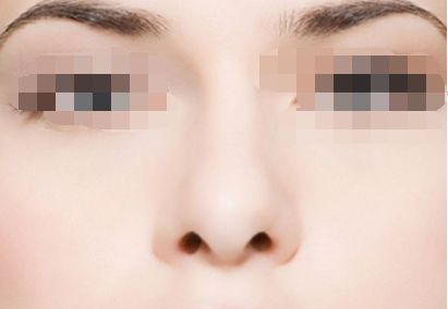 上海九院鼻部整形十強醫(yī)生名單公布，修復(fù)專家排名引人矚目