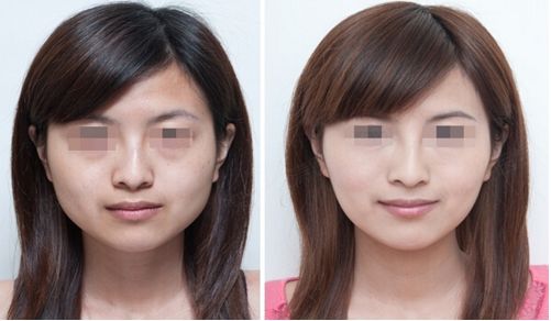 南昌美容整形醫(yī)院排名及推薦（2023年更新）