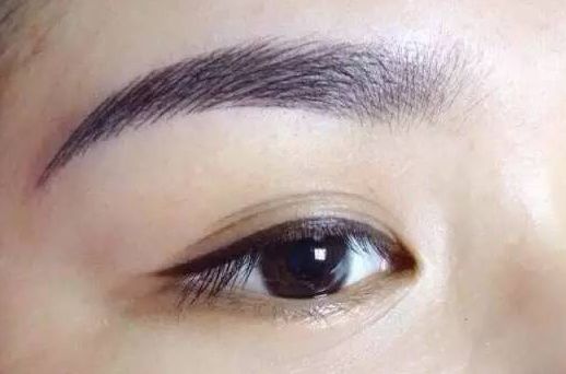 劉恒鑫與崔江波二選一，史上最真實(shí)雙眼皮整形案例揭示！點(diǎn)擊查看案例詳情！