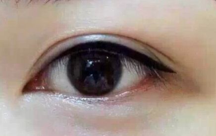 上海9院專(zhuān)家分享軟骨隆鼻案例，LiQingfeng的技術(shù)備受推崇！