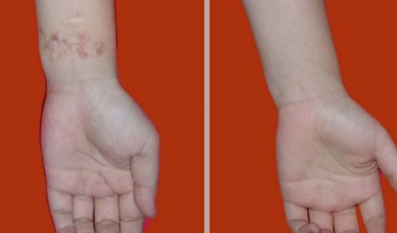 冬季補水逆轉(zhuǎn)肌膚暗沉，白皙水潤大蛻變