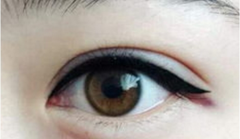 廣東做隆鼻哪家醫(yī)院的技術(shù)好？這五家公立醫(yī)院是值得一試的嗎？