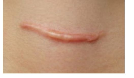 殷佳鵬整形醫(yī)生的技術(shù)與價(jià)格如何？