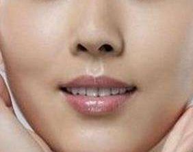 上海眼科專家魏少魁2023年眼睛矯正技術(shù)實戰(zhàn)分享