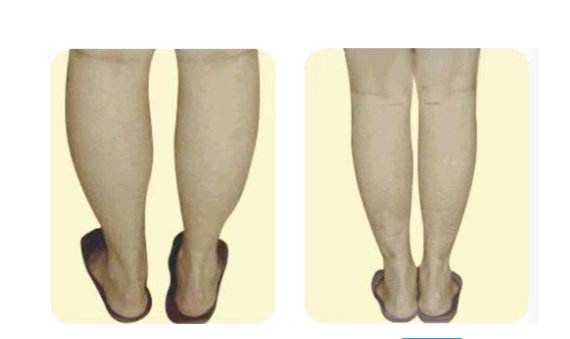 福州雷雪華醫(yī)生打造的鼻子效果如何？醫(yī)生實(shí)力及案例揭示