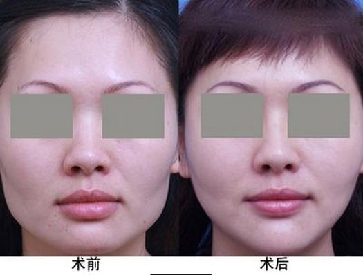 中國最受歡迎的十大整形醫(yī)院評選結(jié)果公布