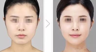 天津整形醫(yī)院綜合師資力量、設(shè)備設(shè)施等實(shí)力分析