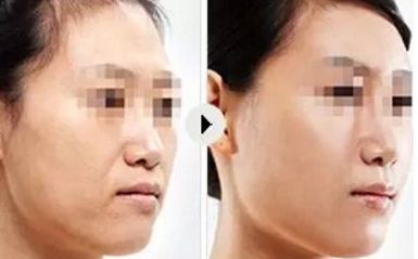 合肥青少年錯(cuò)合畸形治療專家吳建華推薦