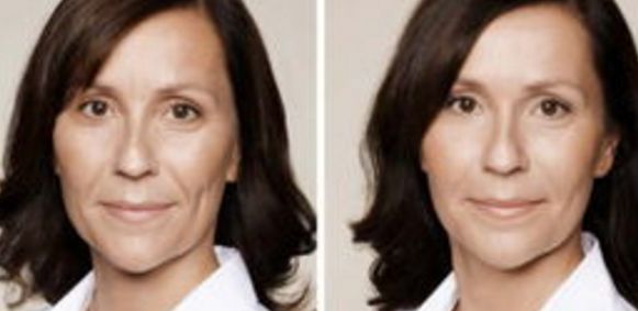 西安哪家醫(yī)院做隆鼻好？整形鼻部醫(yī)院匯總6家