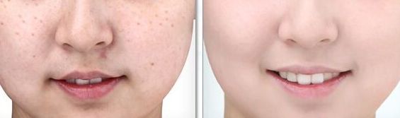 醫(yī)生工作室的預(yù)約方式介紹！蘇薇潔醫(yī)生眼整形工作室的成功案例展示！