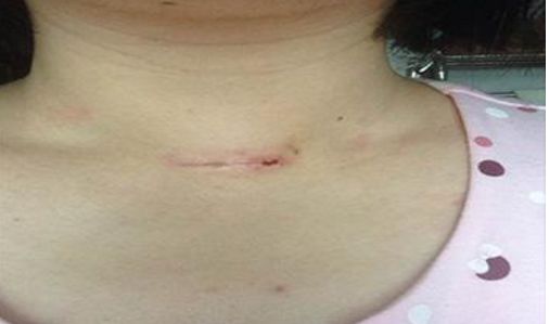 錦州附屬二院口腔修復(fù)科優(yōu)秀專家團隊及種植牙成功案例匯總