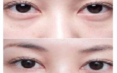 云南雙眼皮醫(yī)生排行榜2023：揭秘5位頂尖專家，讓您輕松煥發(fā)雙目魅力！