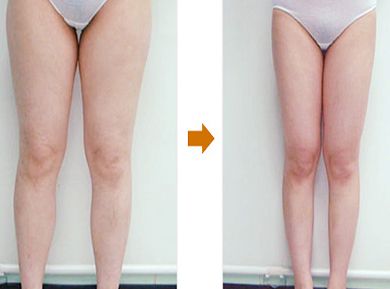 上海柴軍醫(yī)生的鼻子整形案例亮相，效果如何？