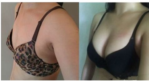 重慶華美眼科醫(yī)生排行榜！五位專家引領潮流，獨家案例與預算揭秘！