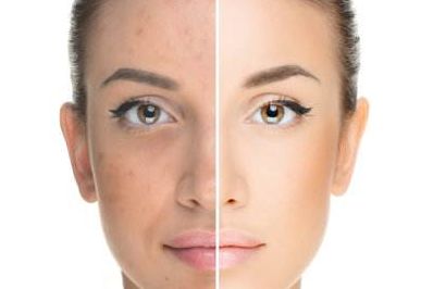 植發(fā)報銷醫(yī)保指南及價格解析