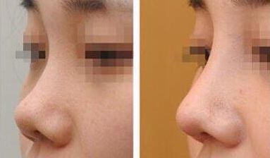 上海第九人民醫(yī)院乳房重塑的頂尖醫(yī)生有誰？專家推薦+服務(wù)收費(fèi)參考