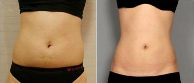 蘇州美容整形醫(yī)院綜合實力巔峰，排名前三不能錯過